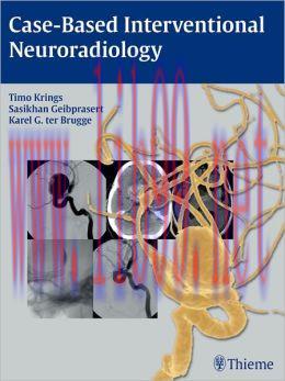 [AME]Case-Based Interventional Neuroradiology