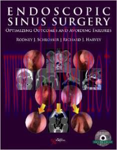 [AME]Endoscopic Sinus Surgery: Optimizing Outcomes and Avoiding Failures