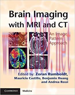 (PDF)Brain Imaging with MRI and CT (Cambridge Medicine (Hardcover)) 1st Edition
