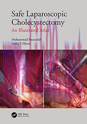 [AME]Safe Laparoscopic Cholecystectomy: An Illustrated Atlas (Original PDF)