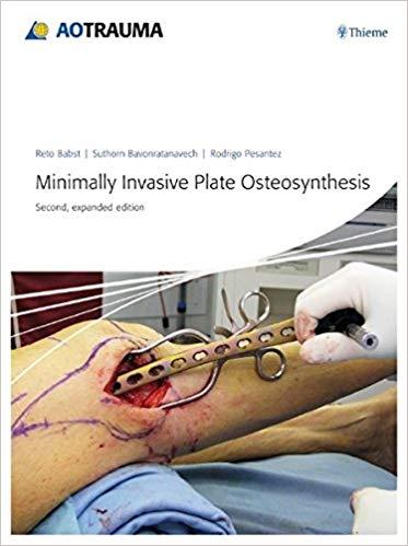 Minimally Invasive Plate Ostheosynthesis (MIPO) Second Expanded Edition
