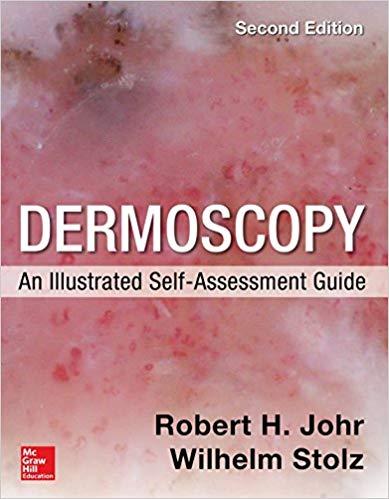 Dermoscopy An Illustrated Self-Assessment Guide, Second Edition