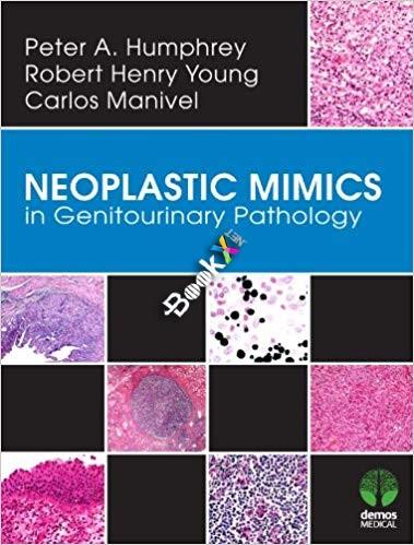 Neoplastic Mimics in Genitourinary Pathology