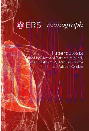 [PDF]ERS Monograph 82 Tuberculosis