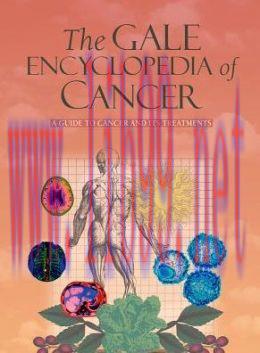[AME]Gale Encyclopedia of Cancer, 4th Edition
