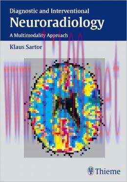 [AME]Diagnostic and Interventional Neuroradiology