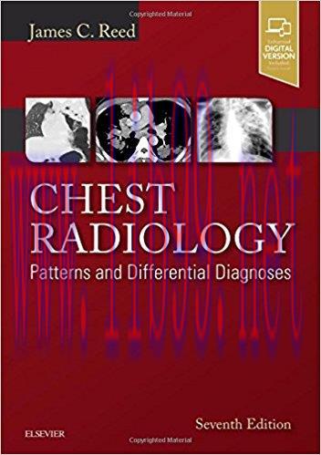 [AME]Chest Radiology: Patterns and Differential Diagnoses, 7th Edition (PDF)