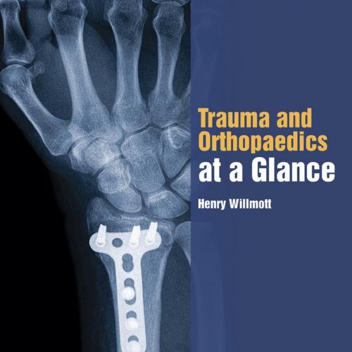 Trauma and Orthopaedics at a Glance - Henry Willmott