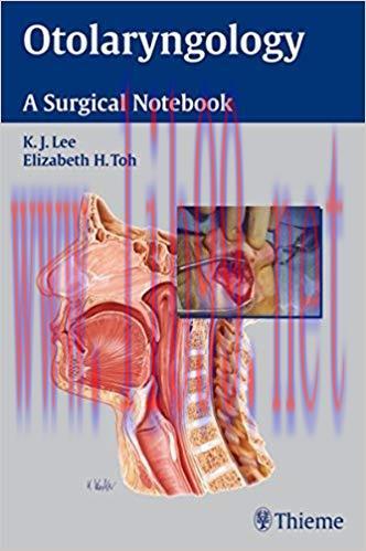 [PDF]Otolaryngology - A Surgical Notebook