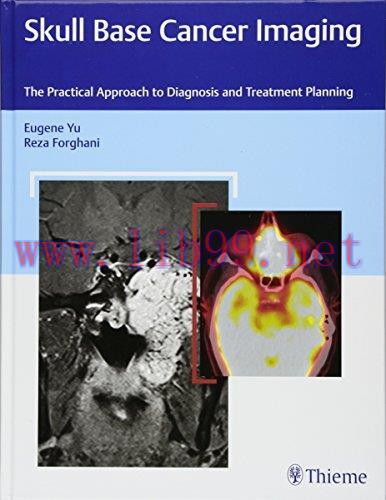 [AME]Skull Base Cancer Imaging: The Practical Approach to Diagnosis and Treatment Planning (Ori...