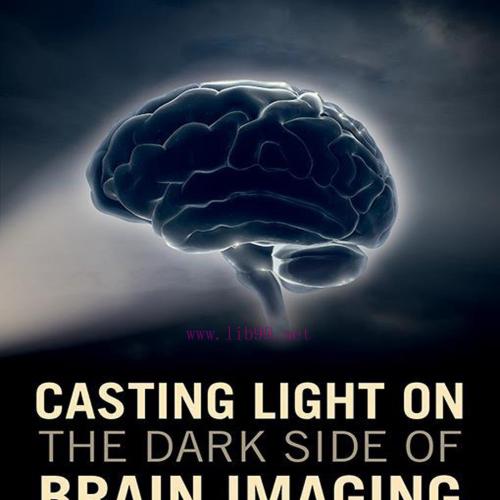 [AME]Casting Light on the Dark Side of Brain Imaging (EPUB)