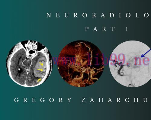 [AME]Neuroradiology Part 1 - Gregory Zaharchuk, M.D. 2021 (CMEScience) (CME Videos)