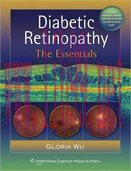 [AME]Diabetic Retinopathy: The Essentials