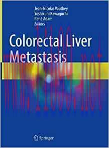 [AME]Colorectal Liver Metastasis, 1st edition (EPUB)