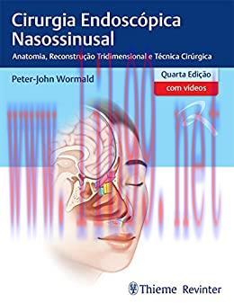 [AME]Cirurgia Endosc&oacute;pica Nasossinusal: Anatomia, Reconstru&ccedil;&atilde;o Tridimensional e T&eacute;cnica Cir&uacute;rgi...