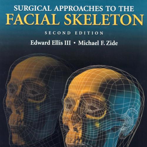 Surgical Approaches To The Facial Skeleton,2nd Ediiton - Wei Zhi
