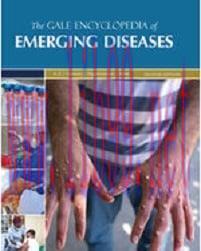 [AME]The Gale Encyclopedia of Emerging Diseases, 2nd Edition (EPUB)