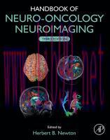 [PDF]Handbook of Neuro-Oncology Neuroimaging