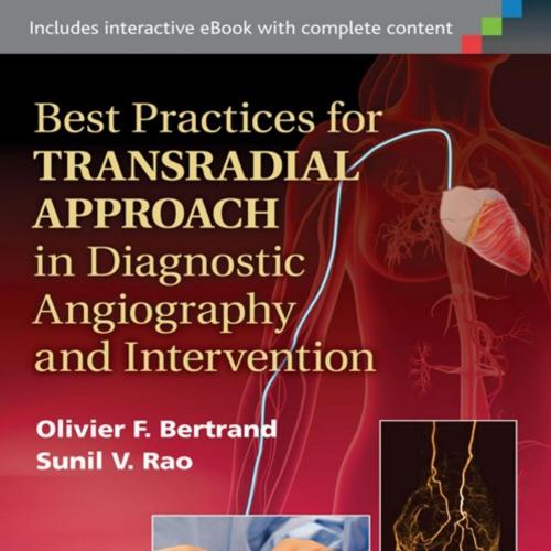 Best Practices for Transradial Approach in Diagnostic Angiography and Intervention