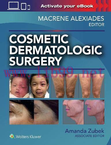 [AME]Cosmetic Dermatologic Surgery (EPUB)