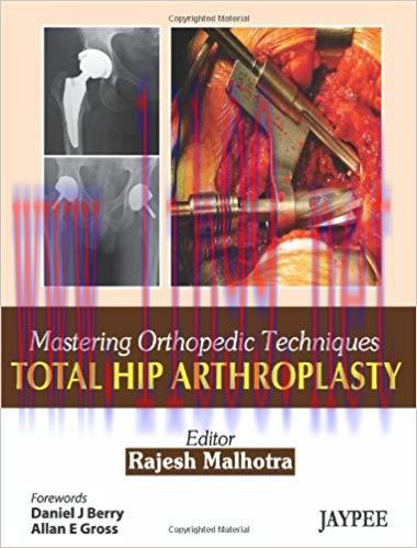 [PDF]Mastering Orthopedic Techniques Total Hip Arthroplasty