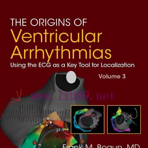 [AME]The Origins of Ventricular Arrhythmias: Using the ECG as a Key Tool for Localization, Volu...