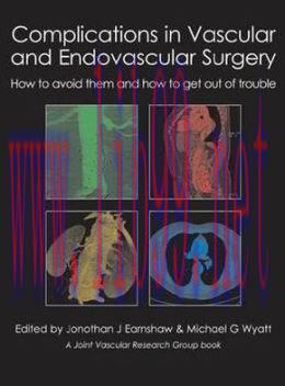 [AME]Complications in Vascular and Endovascular Surgery: How to Avoid Them and How to Get Out o...