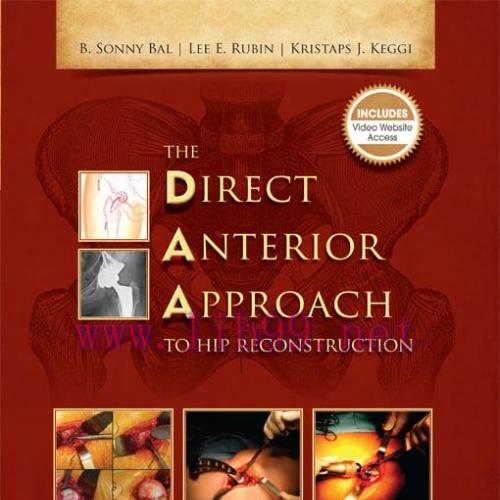 [AME]The Direct Anterior Approach to Hip Reconstruction (Original PDF)