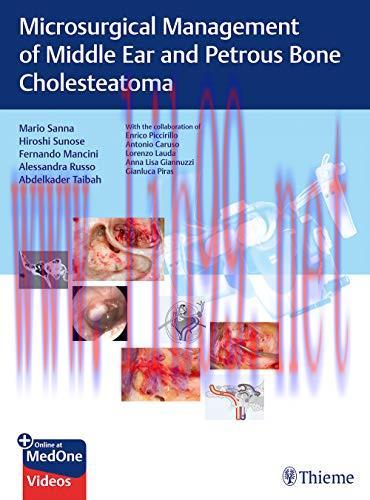 [AME]Microsurgical Management of Middle Ear and Petrous Bone Cholesteatoma (Original PDF)