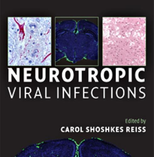 Neurotropic Viral Infections - Carol Shoshkes Reiss (edt)