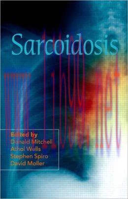 [AME]Sarcoidosis