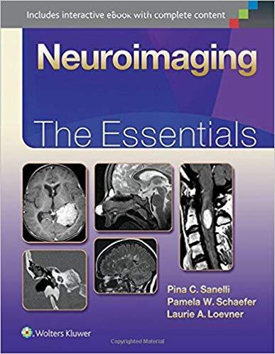 Neuroimaging - The Essentials