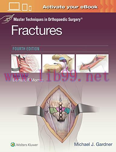 [AME]Master Techniques in Orthopaedic Surgery: Fractures, 4ed (ePub+Converted PDF)