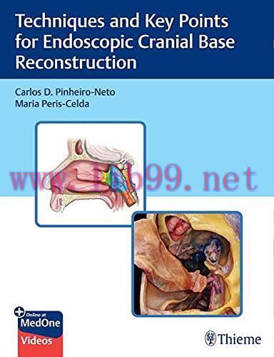 [AME]Techniques and Key Points For Endoscopic Cranial Base Reconstruction (Original PDF+Videos)