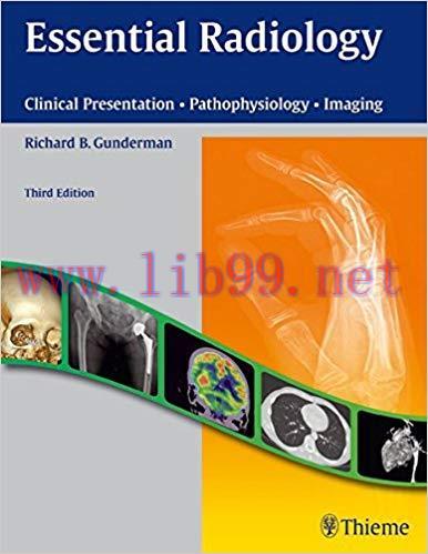 [PDF]Essential Radiology: Clinical Presentation Pathophysiology Imaging 3rd edition