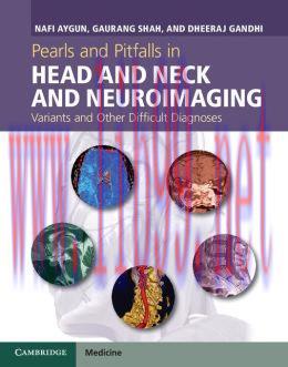 [AME]Pearls and Pitfalls in Head and Neck and Neuroimaging: Variants and Other Difficult Diagno...