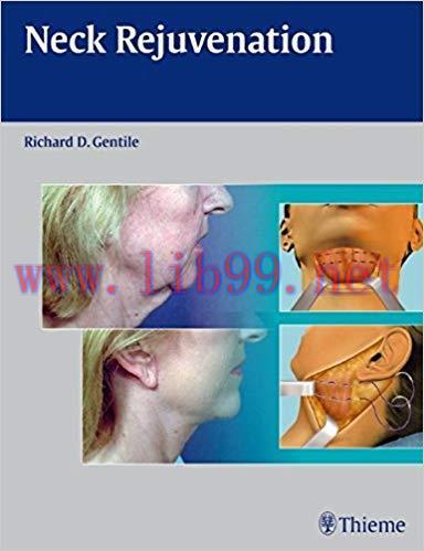 [PDF]Neck Rejuvenation [Richard D. Gentile]
