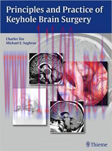 [AME]Principles and Practice of Keyhole Brain Surgery