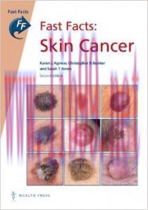 [AME]Fast Facts: Skin Cancer, 2e