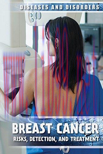 [AME]Breast Cancer: Risks, Detection, and Treatment (Diseases & Disorders) (Original PDF)