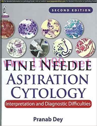 [PDF]Fine Needle Aspiration Cytology Interpretation and Diagnostic Difficulties, 2E