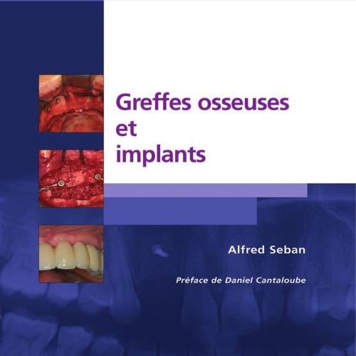 Greffes osseuses et implants
