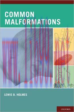 [AME]Common Malformations