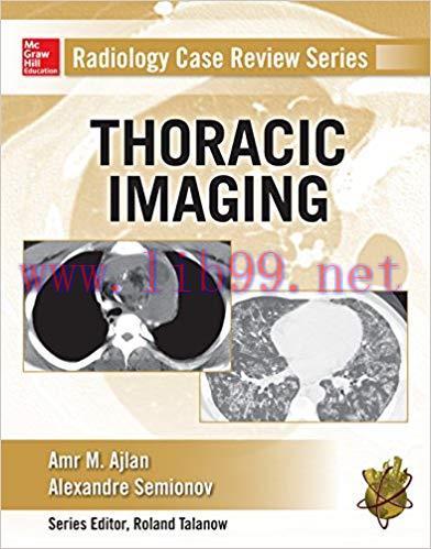 [PDF]Radiology Case Review Series - Thoracic Imaging
