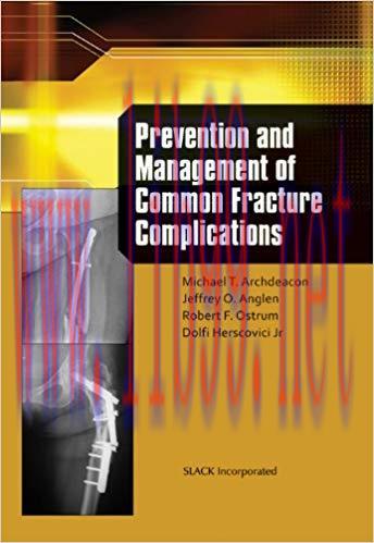 [PDF]Prevention and Management of Common Fracture Complications