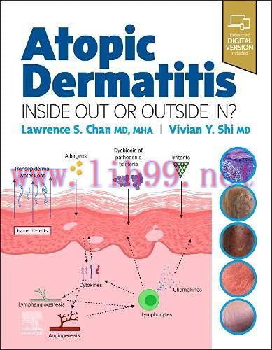 [AME]Atopic Dermatitis: Inside Out or Outside In (Original PDF)
