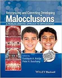 Recognizing and Correcting Developing Malocclusions - A Problem-Oriented Approach to Orthodonti...