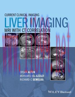 [AME]Liver Imaging: MRI with CT Correlation