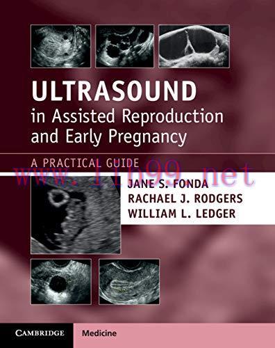 [AME]Ultrasound in Assisted Reproduction and Early Pregnancy: A Practical Guide (Original PDF)