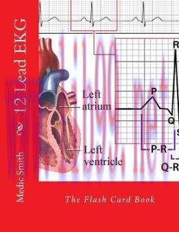 [AME]12 Lead EKG: The Flash Card Book (EPUB)